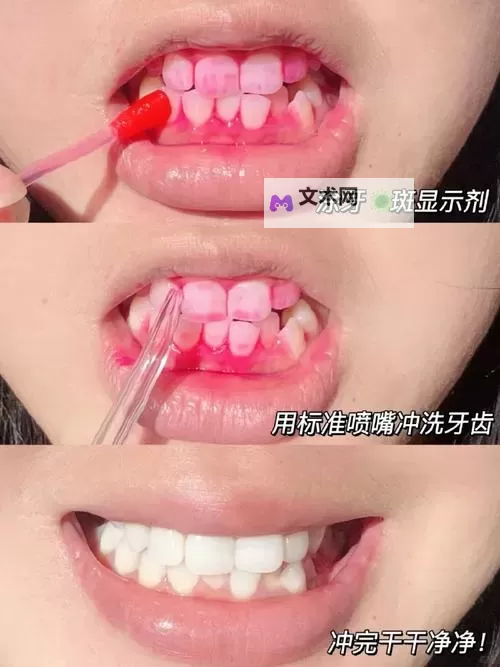 用牙齿轻吸咬小豆:一段关于细腻感官体验的轻描淡写图1