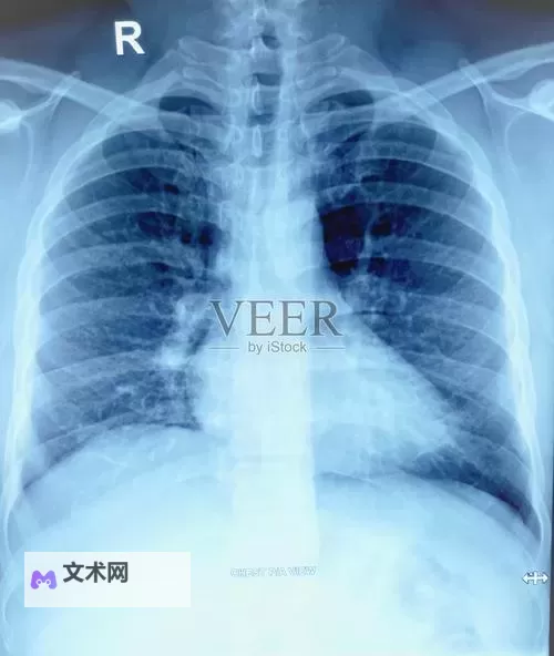 我想看胸片曝光2024今日更新：最新动态一览图1